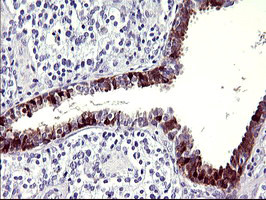 SERPINB3 Antibody in Immunohistochemistry (Paraffin) (IHC (P))