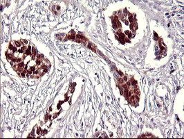 SERPINB3 Antibody in Immunohistochemistry (Paraffin) (IHC (P))