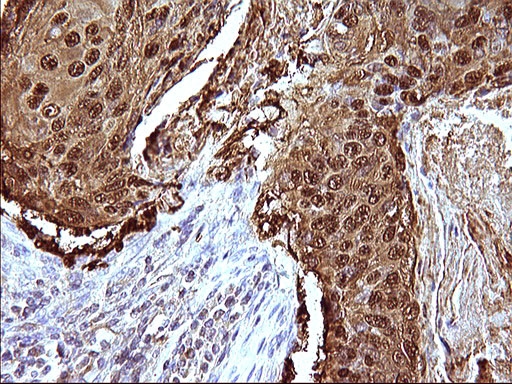 SERPINB3 Antibody in Immunohistochemistry (Paraffin) (IHC (P))