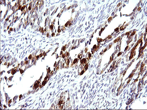 SERPINB3 Antibody in Immunohistochemistry (Paraffin) (IHC (P))