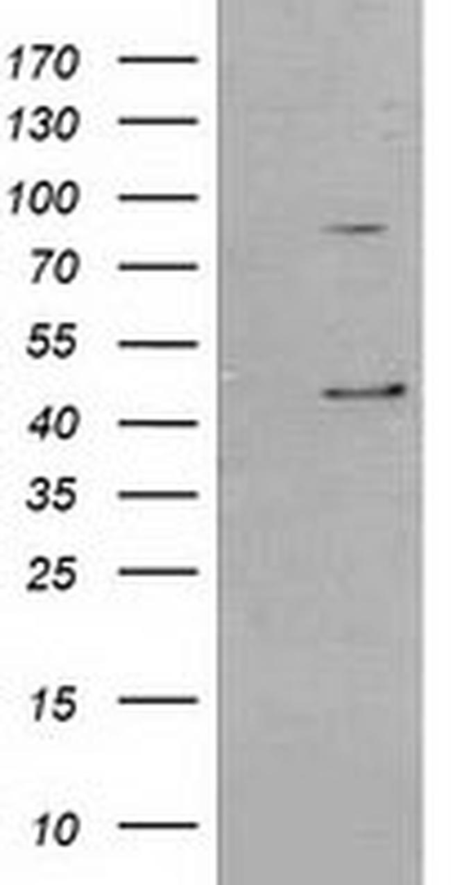 SERPINB3 Antibody in Western Blot (WB)