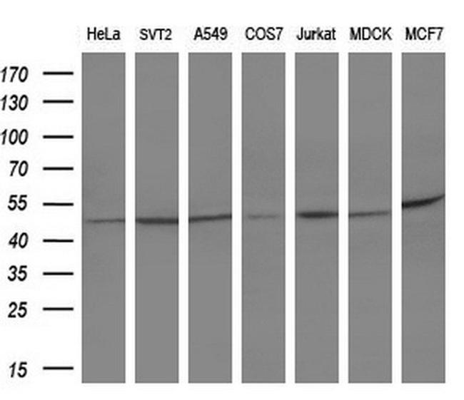 SERPINB3 Antibody in Western Blot (WB)