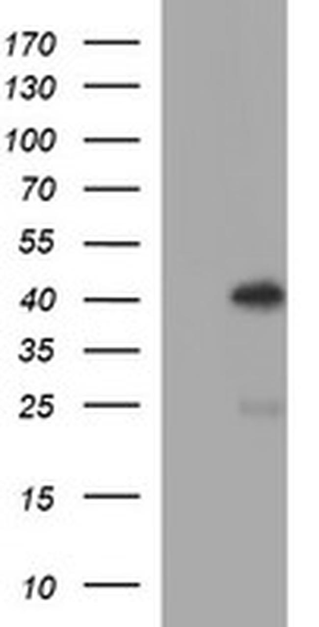 SERPINB3 Antibody in Western Blot (WB)