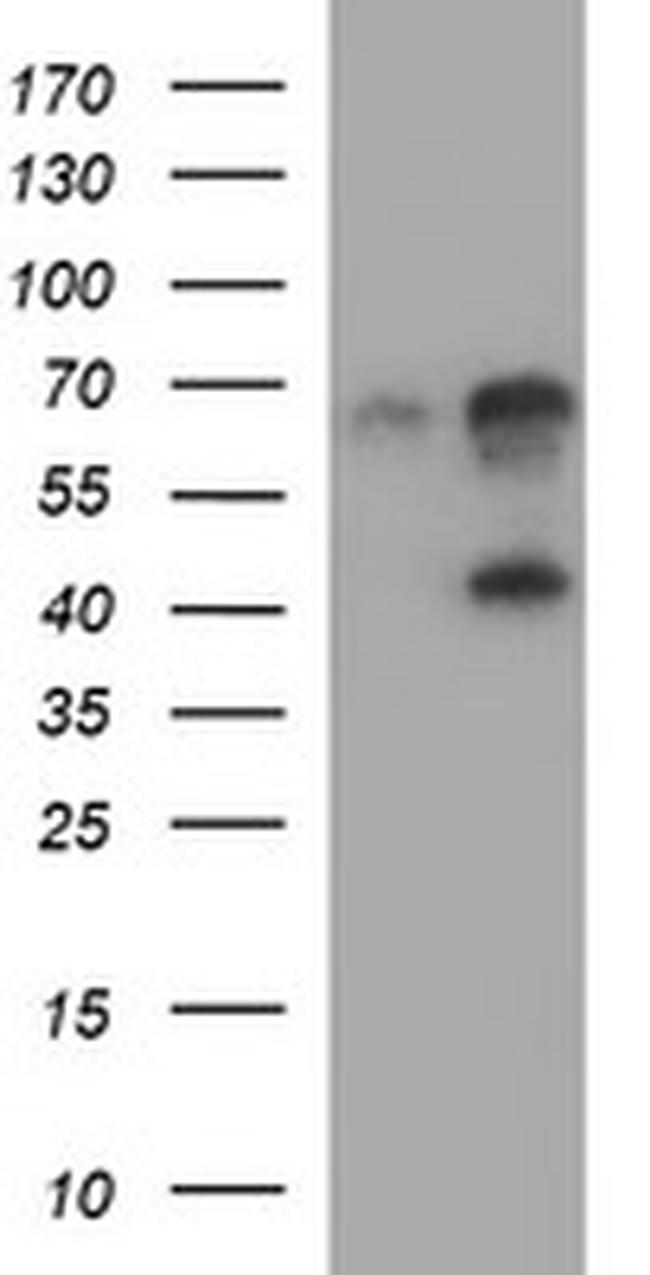 SERPINB3 Antibody in Western Blot (WB)