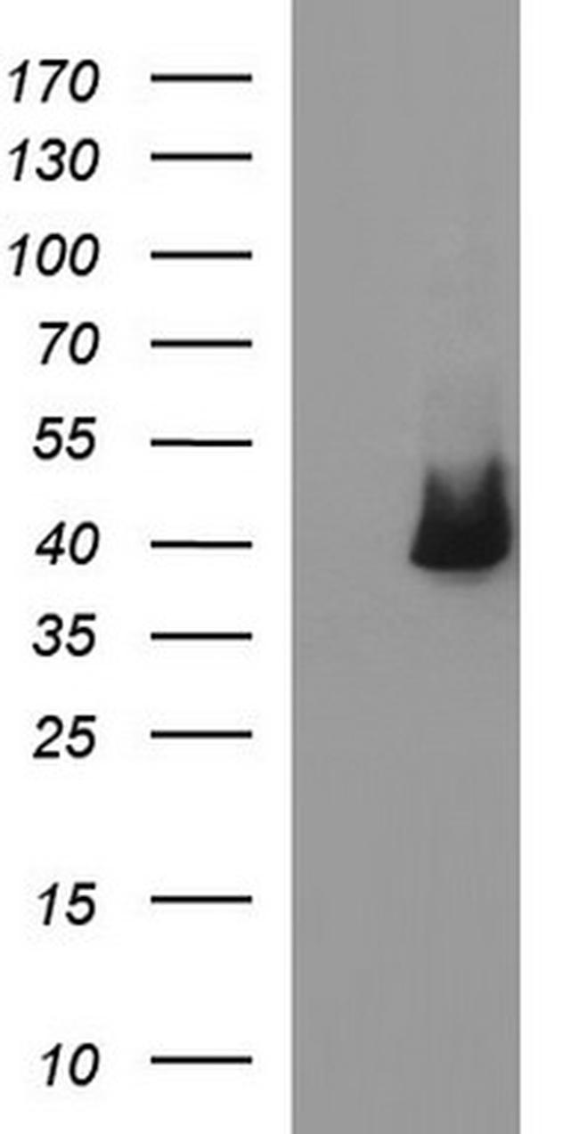 SERPINB3 Antibody in Western Blot (WB)