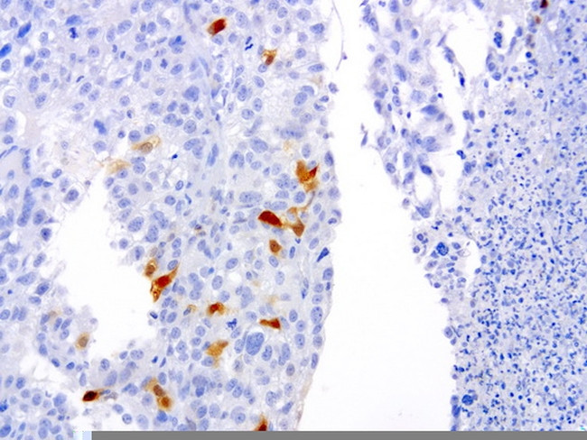 SERPINB4 Antibody in Immunohistochemistry (Paraffin) (IHC (P))