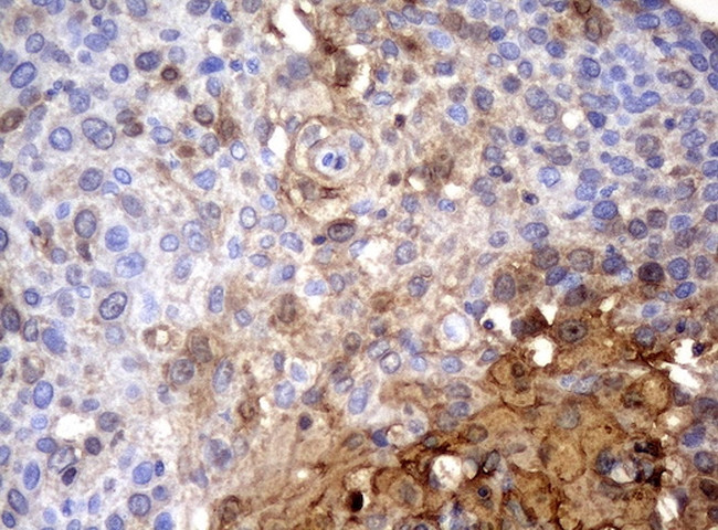 SERPINB4 Antibody in Immunohistochemistry (Paraffin) (IHC (P))