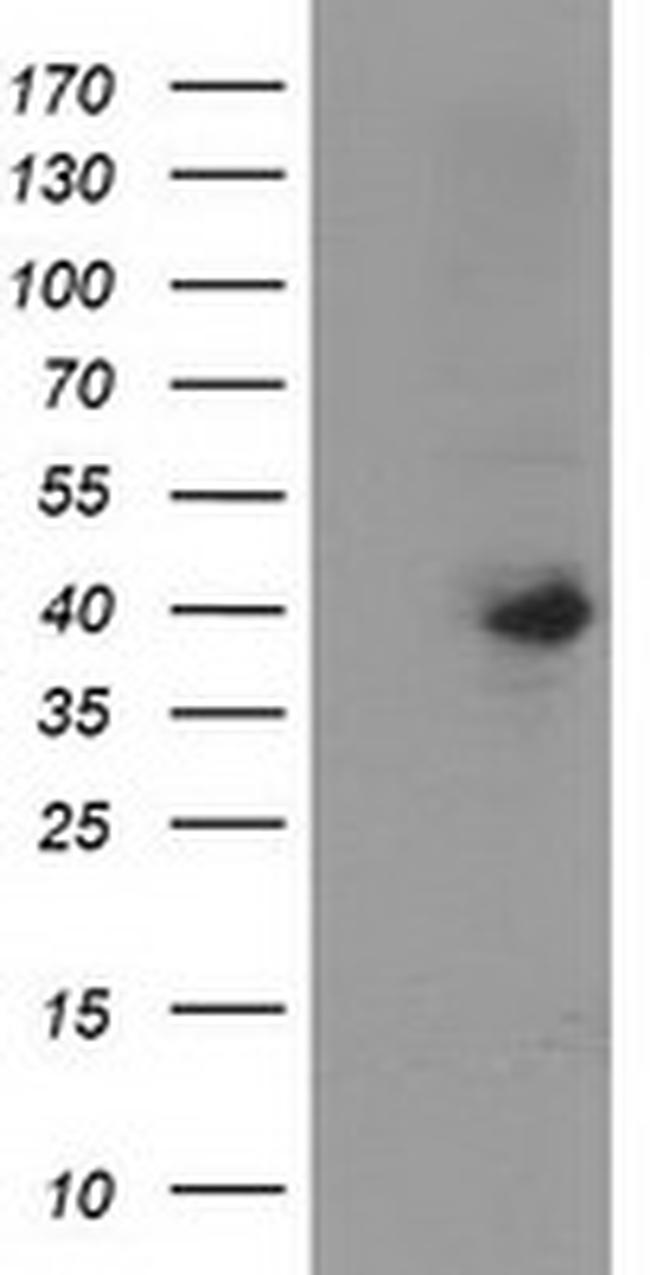 SERPINB4 Antibody in Western Blot (WB)