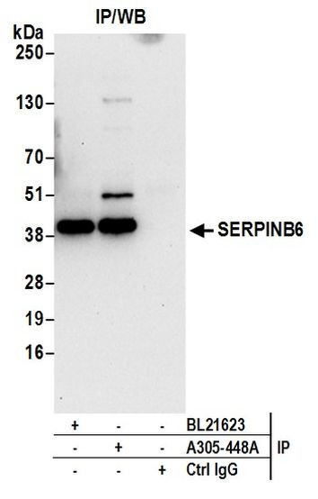 SERPINB6 Antibody in Immunoprecipitation (IP)