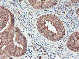 SERPINB6 Antibody in Immunohistochemistry (Paraffin) (IHC (P))