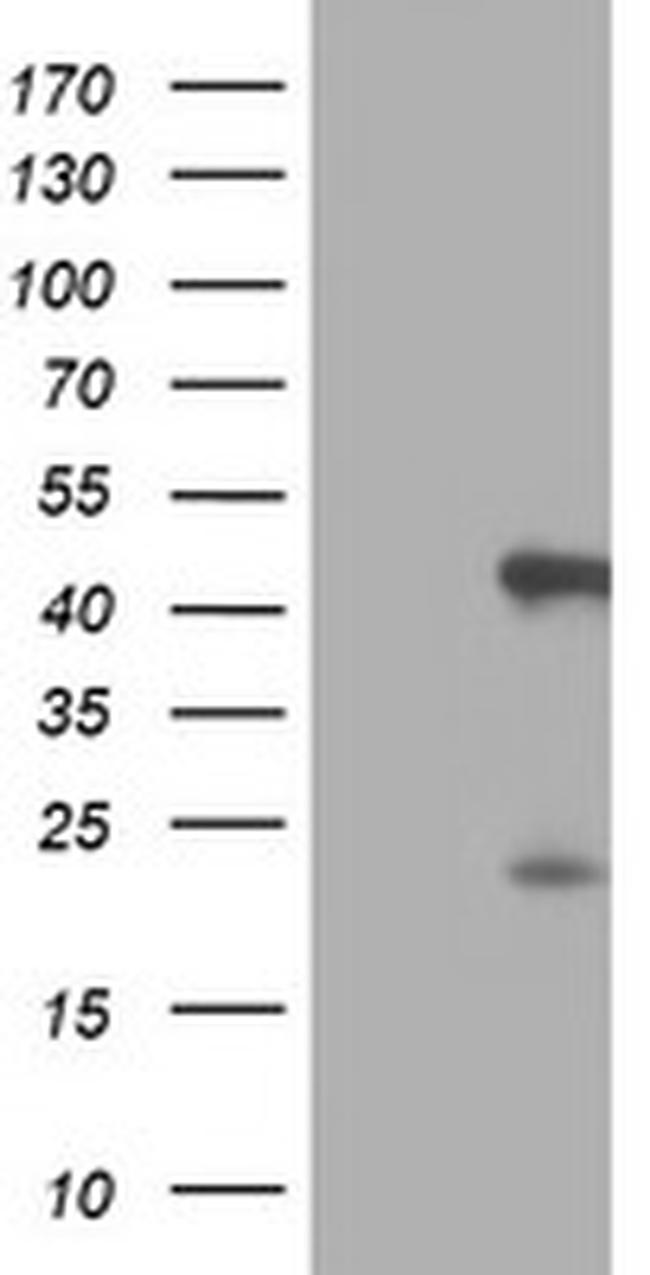 SERPINB6 Antibody in Western Blot (WB)