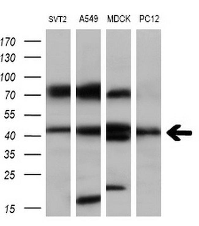 SERPINB6 Antibody in Western Blot (WB)