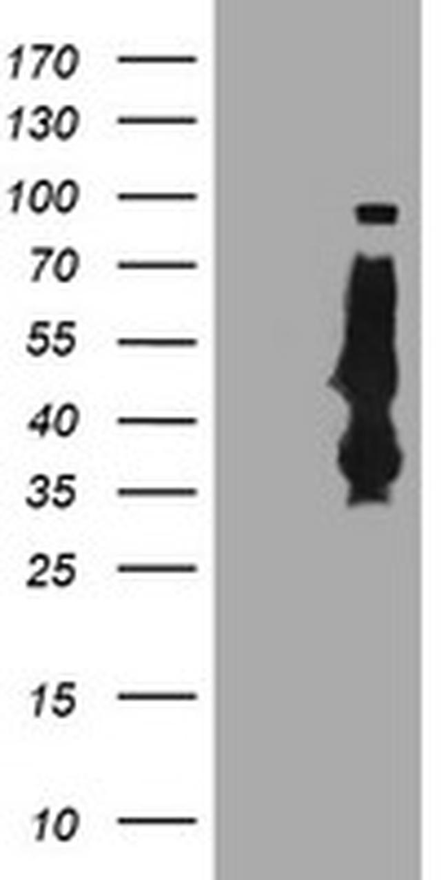 SERPINB6 Antibody in Western Blot (WB)