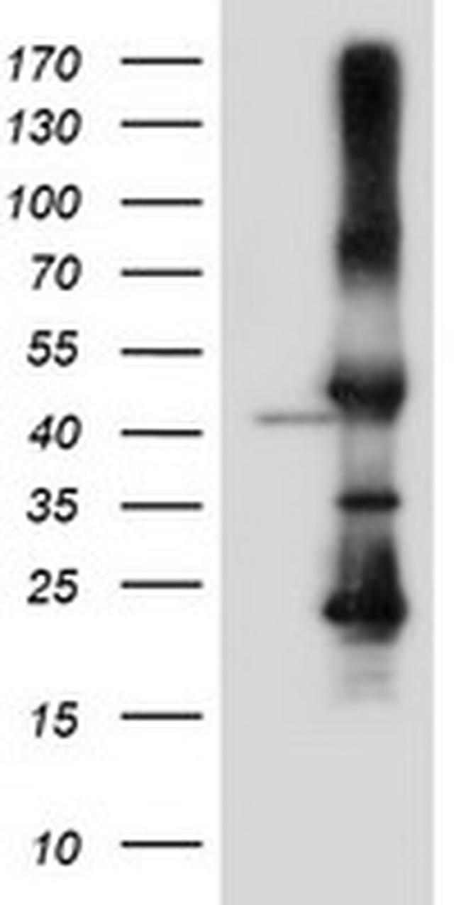 SERPINB6 Antibody in Western Blot (WB)