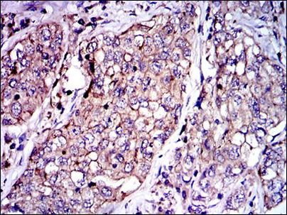 PAI1 Antibody in Immunohistochemistry (Paraffin) (IHC (P))