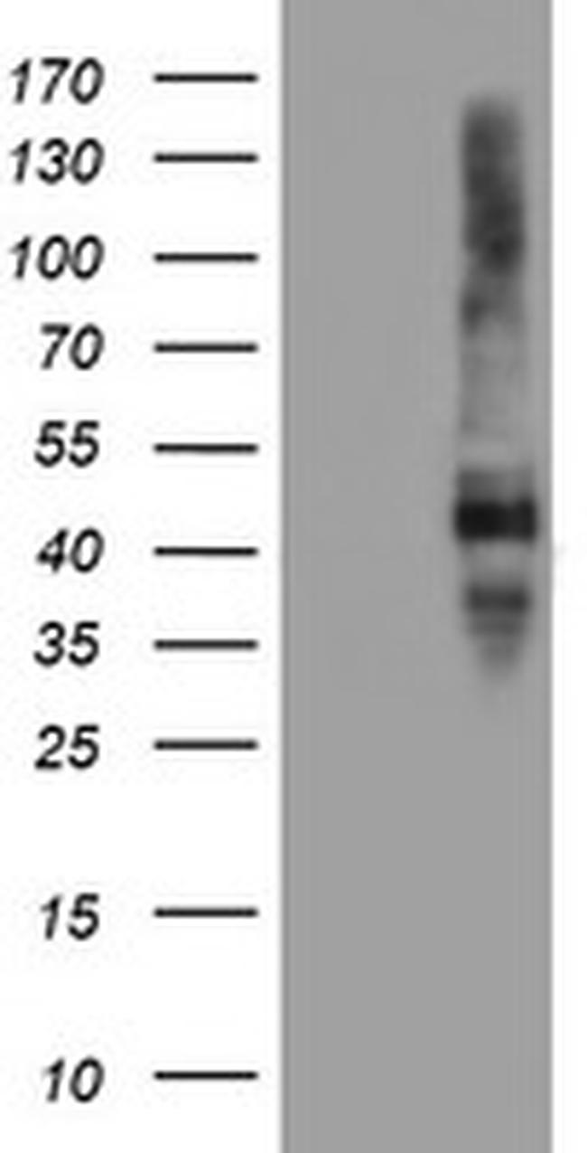 SERPINE2 Antibody in Western Blot (WB)