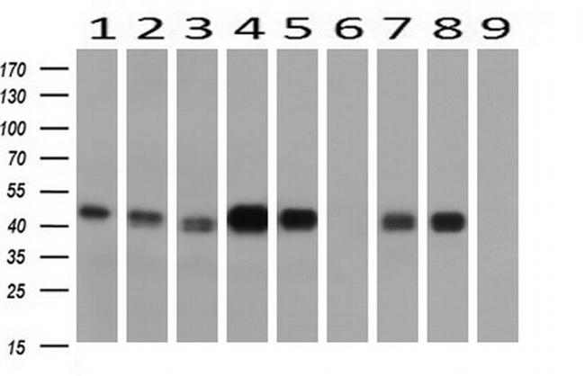 SERPINE2 Antibody in Western Blot (WB)