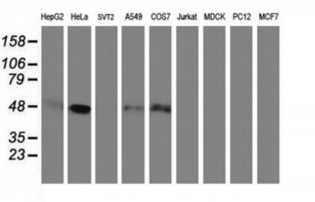 SERPINE2 Antibody in Western Blot (WB)