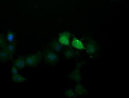 SESTD1 Antibody in Immunocytochemistry (ICC/IF)