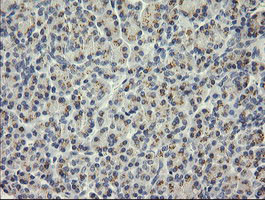 SESTD1 Antibody in Immunohistochemistry (Paraffin) (IHC (P))