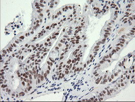 SESTD1 Antibody in Immunohistochemistry (Paraffin) (IHC (P))