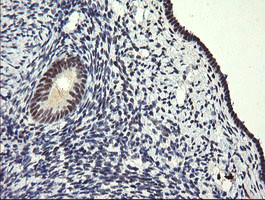 SESTD1 Antibody in Immunohistochemistry (Paraffin) (IHC (P))