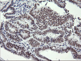 SESTD1 Antibody in Immunohistochemistry (Paraffin) (IHC (P))