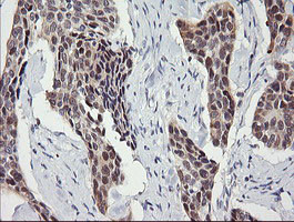 SESTD1 Antibody in Immunohistochemistry (Paraffin) (IHC (P))