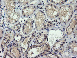 SESTD1 Antibody in Immunohistochemistry (Paraffin) (IHC (P))