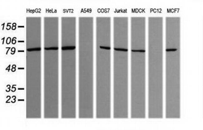 SESTD1 Antibody in Western Blot (WB)