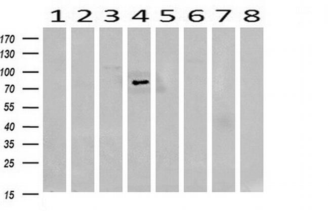 SESTD1 Antibody in Western Blot (WB)