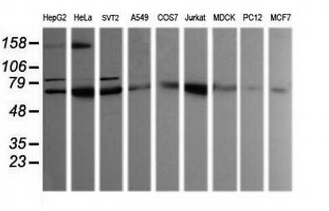 SESTD1 Antibody in Western Blot (WB)