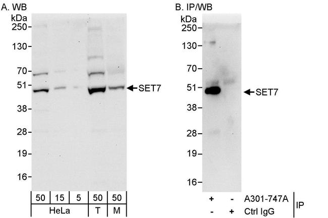 SET7 Antibody in Western Blot (WB)