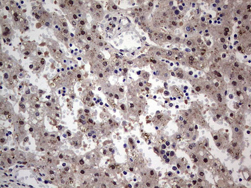 SETD2 Antibody in Immunohistochemistry (Paraffin) (IHC (P))