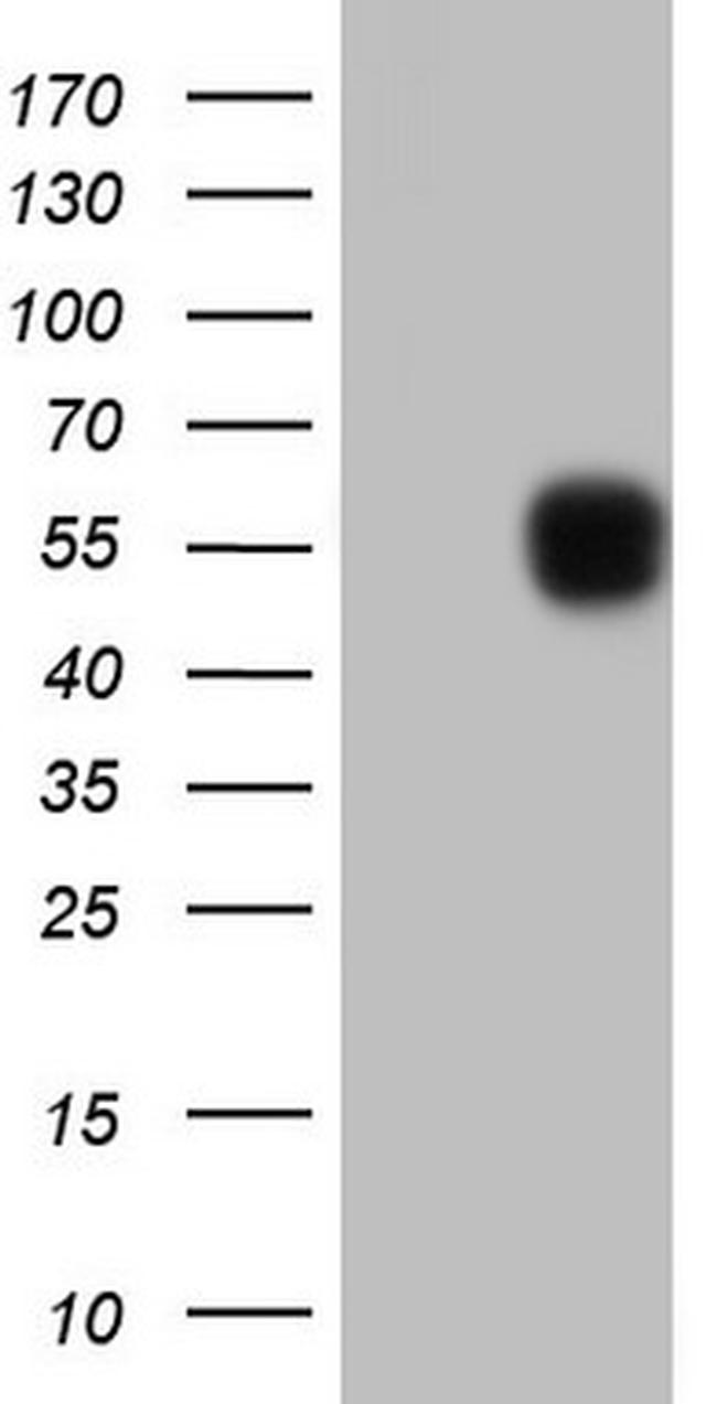 SETD2 Antibody in Western Blot (WB)