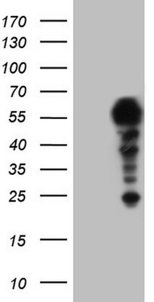 SETD2 Antibody in Western Blot (WB)