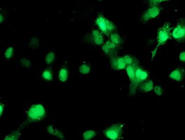 SETD7 Antibody in Immunocytochemistry (ICC/IF)