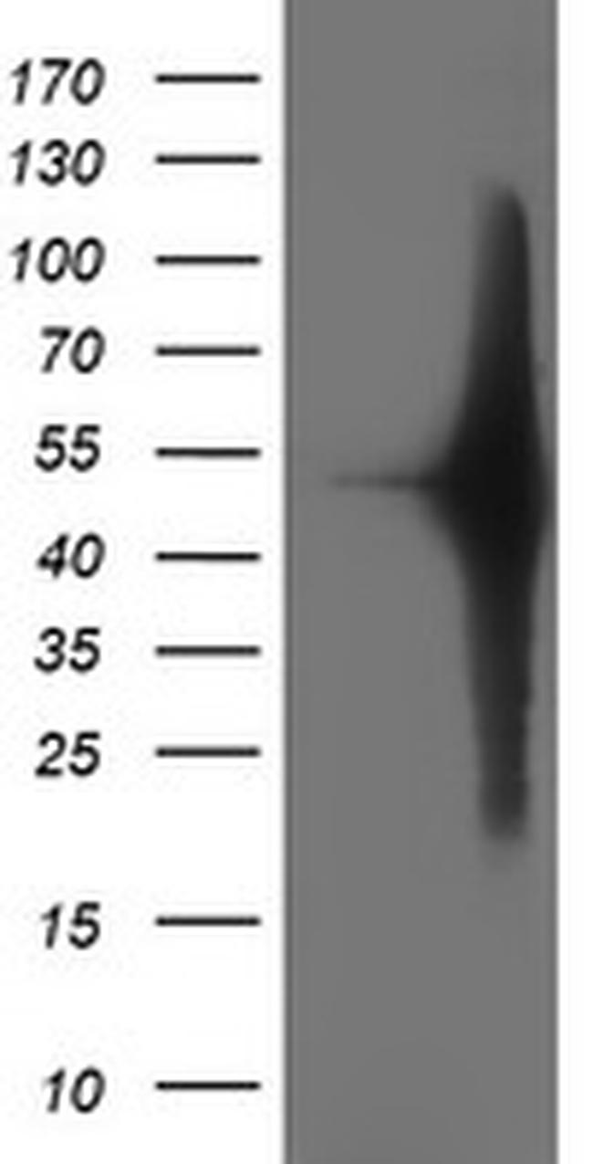 SETD7 Antibody in Western Blot (WB)