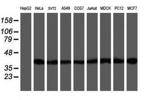 SETD7 Antibody in Western Blot (WB)