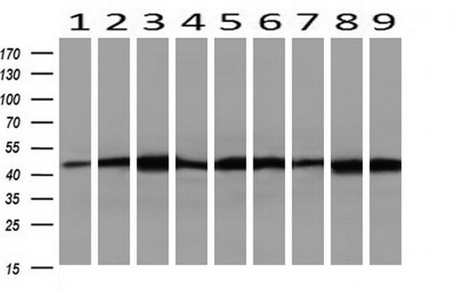 SETD7 Antibody in Western Blot (WB)