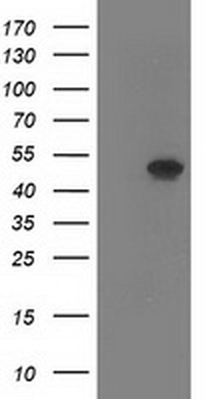 SETD7 Antibody in Western Blot (WB)