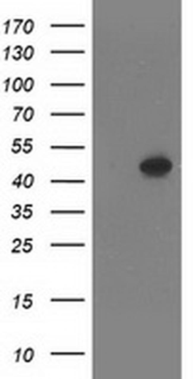 SETD7 Antibody in Western Blot (WB)