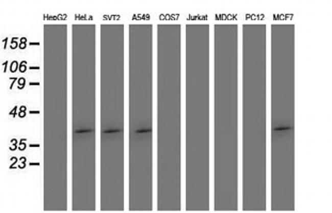 SETD7 Antibody in Western Blot (WB)