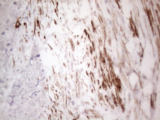 SETD8 Antibody in Immunohistochemistry (Paraffin) (IHC (P))