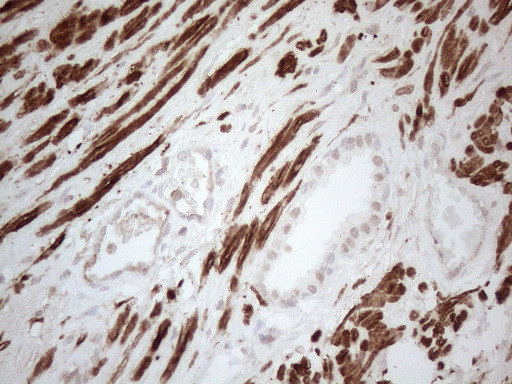 SETD8 Antibody in Immunohistochemistry (Paraffin) (IHC (P))