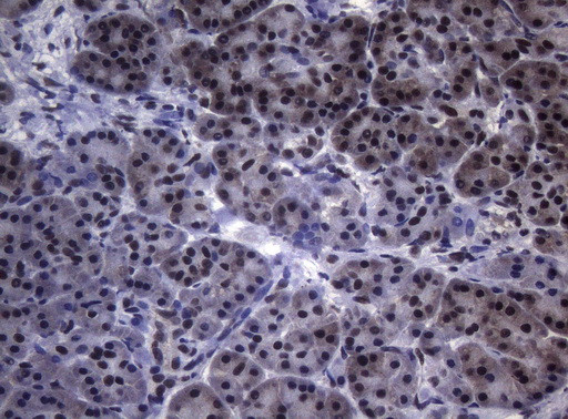 SF1 Antibody in Immunohistochemistry (Paraffin) (IHC (P))