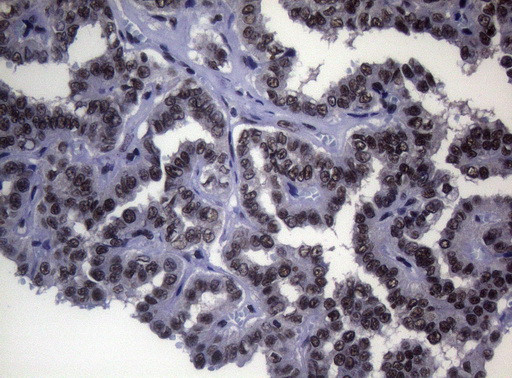 SF1 Antibody in Immunohistochemistry (Paraffin) (IHC (P))