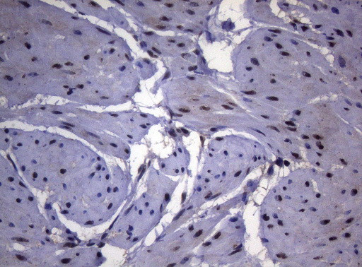 SF1 Antibody in Immunohistochemistry (Paraffin) (IHC (P))