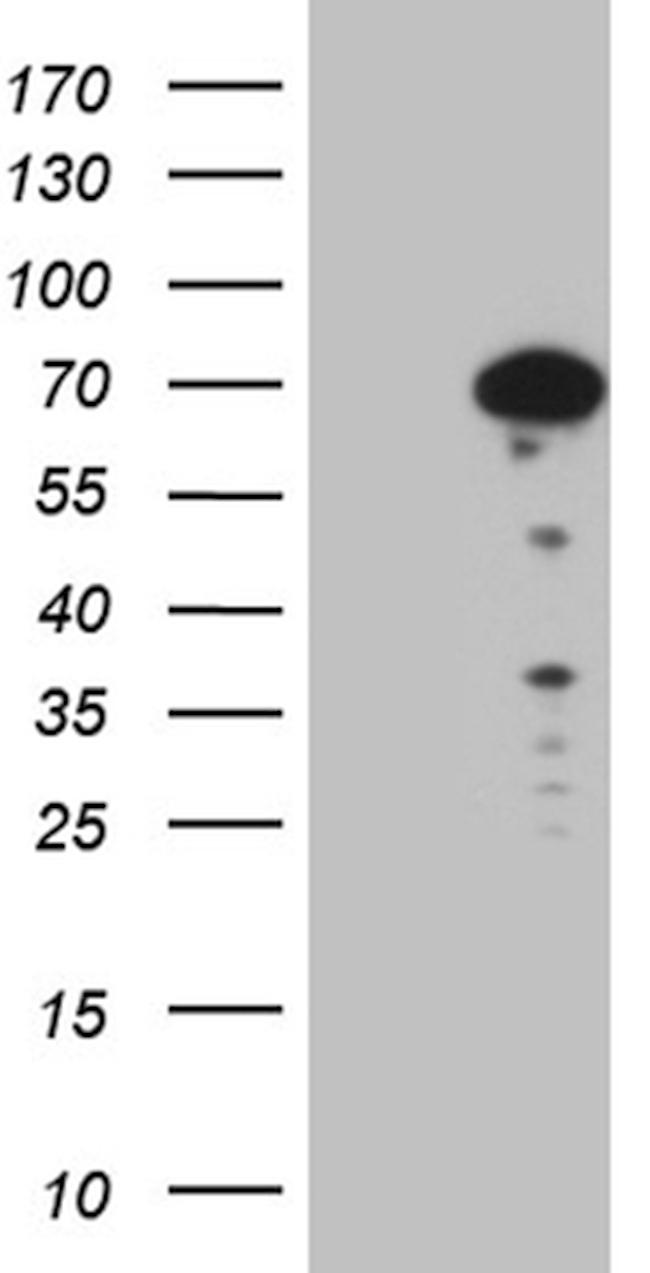 SF1 Antibody in Western Blot (WB)