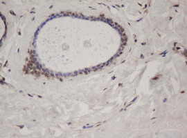 SF3A1 Antibody in Immunohistochemistry (Paraffin) (IHC (P))